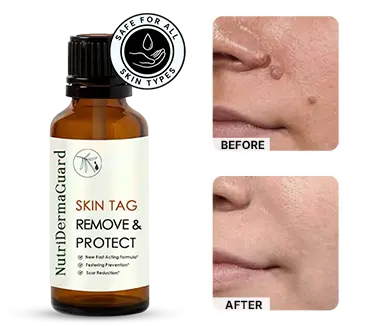 nutirderma_before_after_result